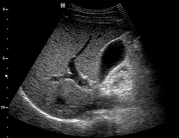 При любых патологиях решение о возможности приема алоэ принимает только врач. При любых патологиях решение о возможности приема алоэ принимает только врач.